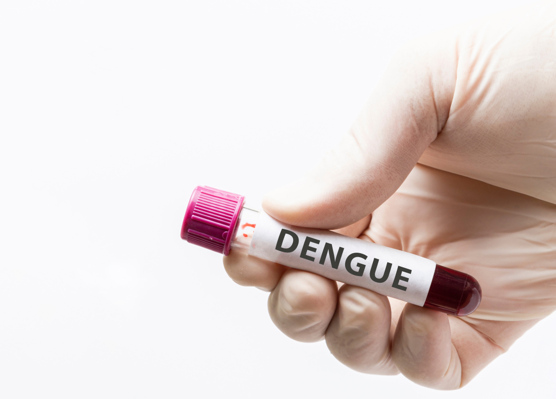 Dengue Test Package